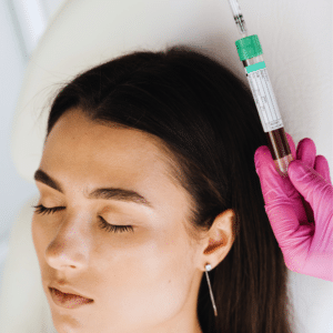 Frau unterzieht sich im Gesicht einer PRP Behandlung in Nürnberg in einer Praxis für Ästhetische Medizin