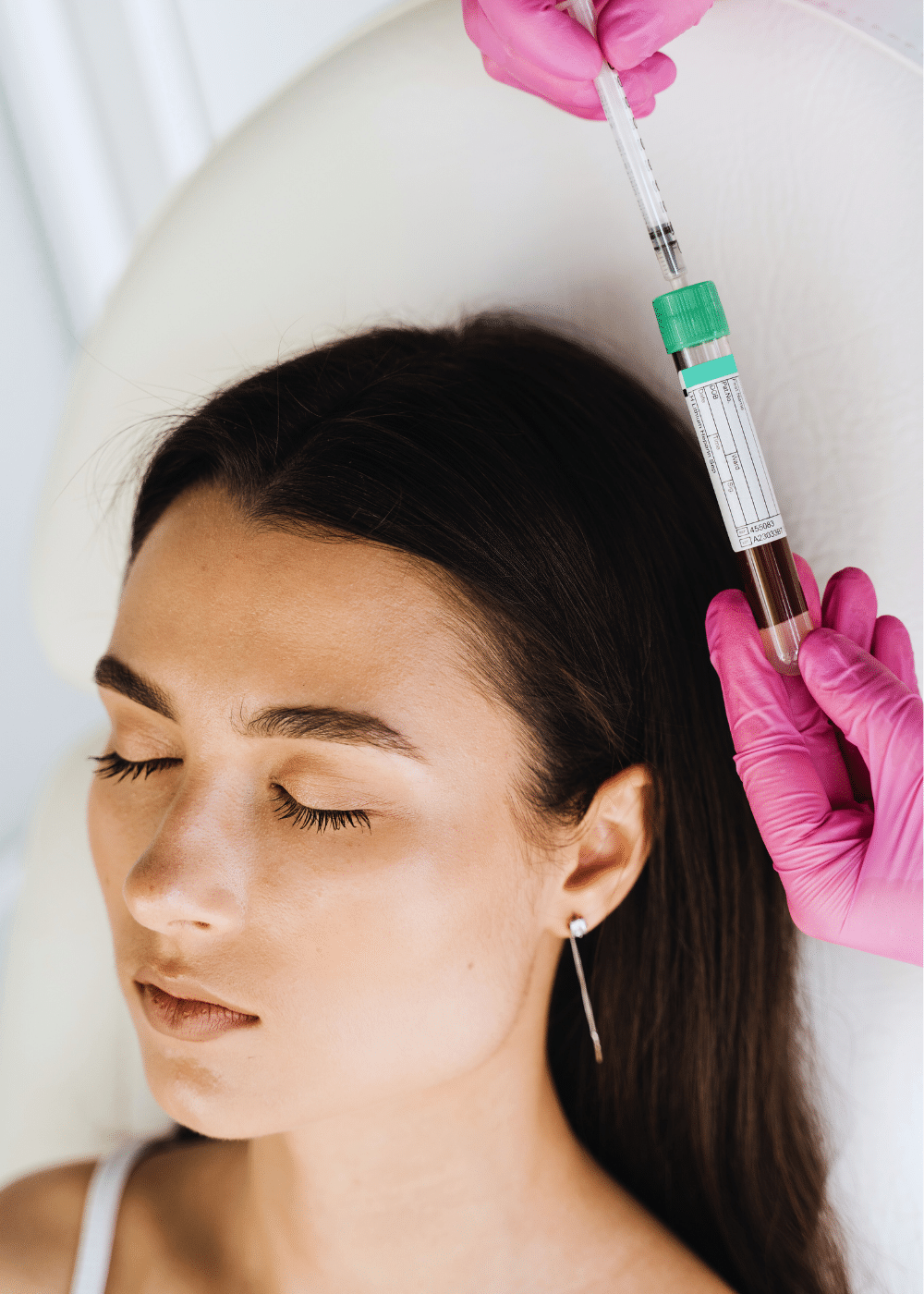 Frau unterzieht sich im Gesicht einer PRP Behandlung in Nürnberg in einer Praxis für Ästhetische Medizin