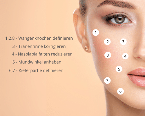 Grafik zum 8 Punkte Lifting